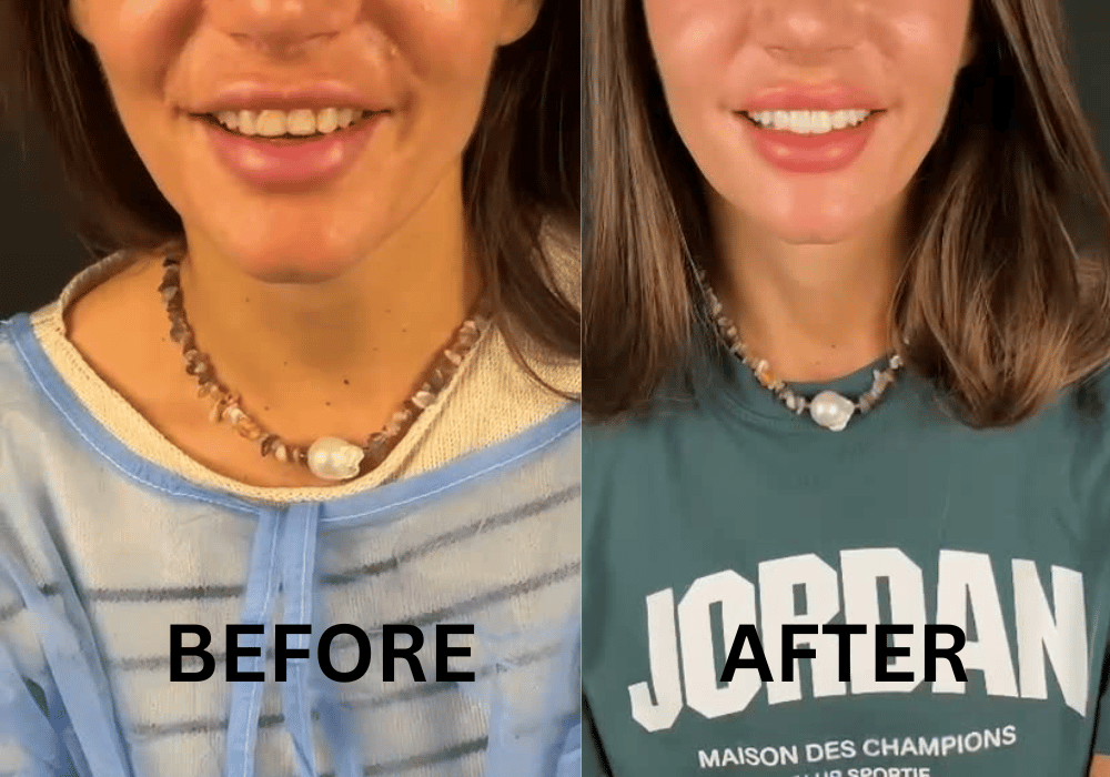 The Signature Smile Experience